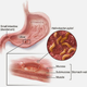 Illustration for article titled Obat Obat Maag Akutem/em